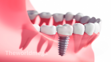 How much does a dental implant cost without insurance?